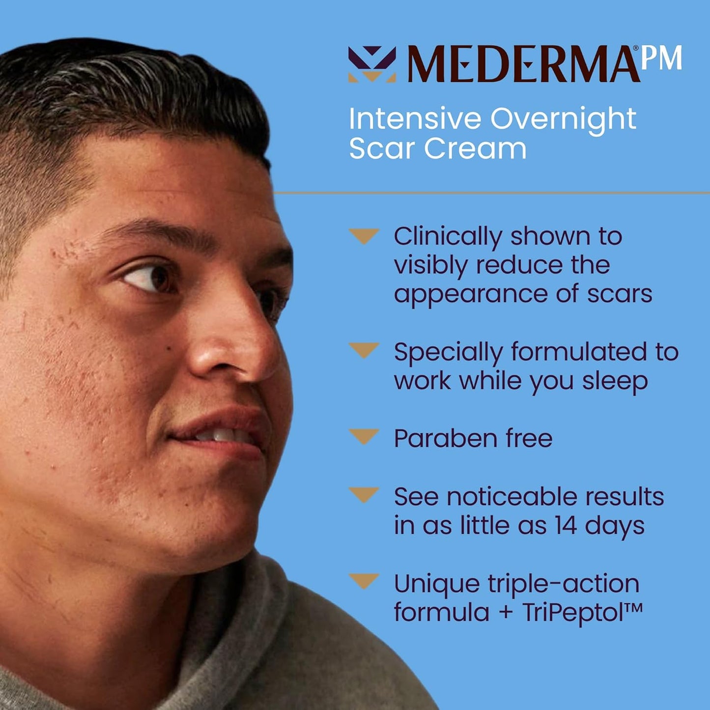 Mederma Stretch Marks Therapy, Helps Prevent and Treat Stretch Marks, Safe to Use When Pregnant & PM Intensive Overnight Scar Cream, Works with Skin's Nighttime Regenerative Activity