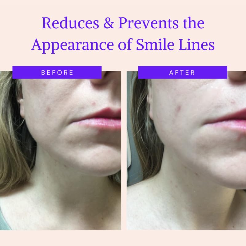 BLUMBODY Face Wrinkle Patches - Anti Wrinkle Facial Patches to Smooth Smile Lines - Non-Silicone Face Patches Wrinkles Tape for Fine Wrinkles between Eyes & Face - For Overnight Wrinkle Use