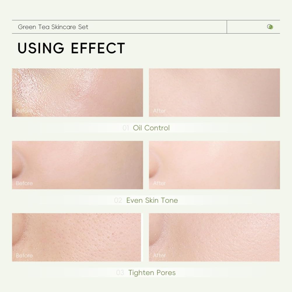 Skin Care Set, Green Tea Skin Care Sets & Kits, Skin Care for Teenage Girls Gift Set with Cleanser, Toner, Serum, Eye Cream, Facial Cream, Facial Skin Care Sets & Kits for Teenage Girls Women