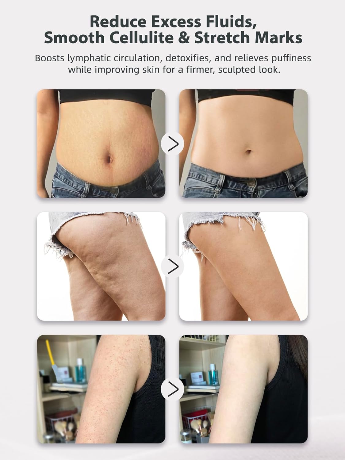 Lymphatic Drainage Massager & Anti Cellulite Massage Tool, Helps Reduce Stretch Marks & Cellulite, for Legs, Arms & Belly, Body Sculpting Machine with Microcurrent, Light, Heat & Vibration