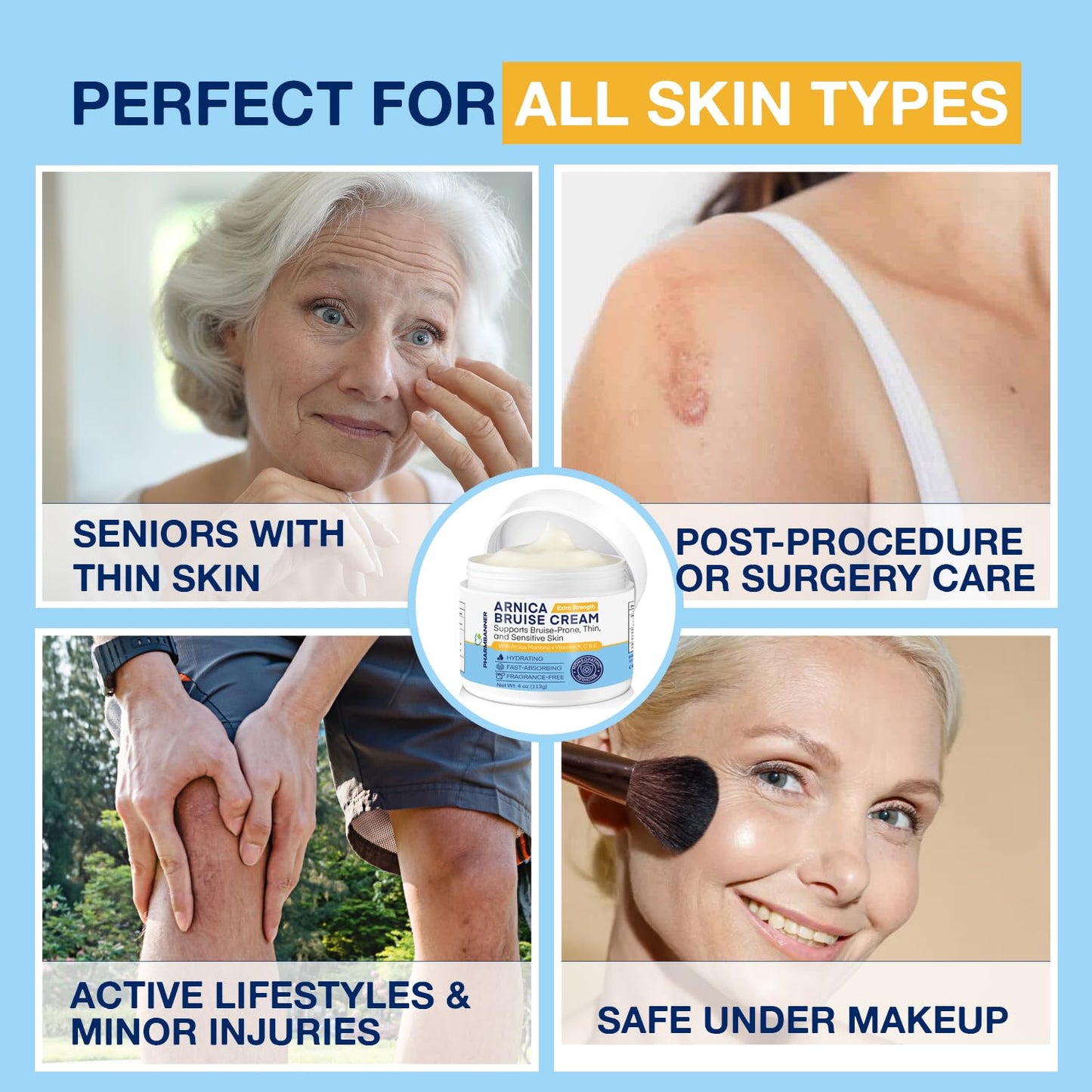 Arnica Bruise Cream Extra Strength – Fast Healing Arnica Montana with Vitamins K, C & E for Bruising, Swelling, Discoloration & Thin Skin – Hydrating Moisturizer for Face & Body – 4 oz