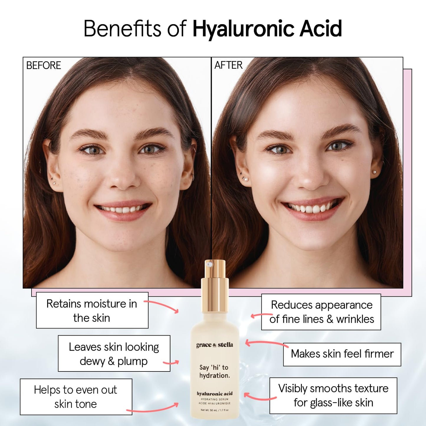grace & stella Award Winning Hyaluronic Acid Serum (30ml/1 fl oz) Hydrating Hyaluronic Acid Serum for Face - Acido Hialuronico for Women - Remove Fine Lines, Wrinkles, Anti Aging - Vegan Skincare